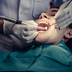 talita chimeli - odontologia em brasilia - dentista em brasilia - cirurgia na gengiva 300