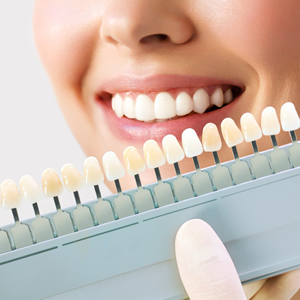 talita chimeli - odontologia em brasilia - dentista em brasilia - clareamento dental 300