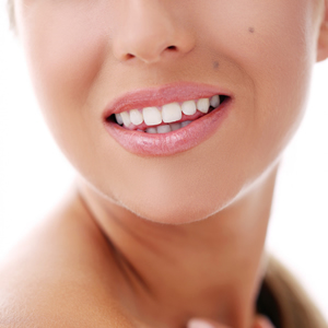 talita chimeli - odontologia em brasilia - dentista em brasilia - faceta 300